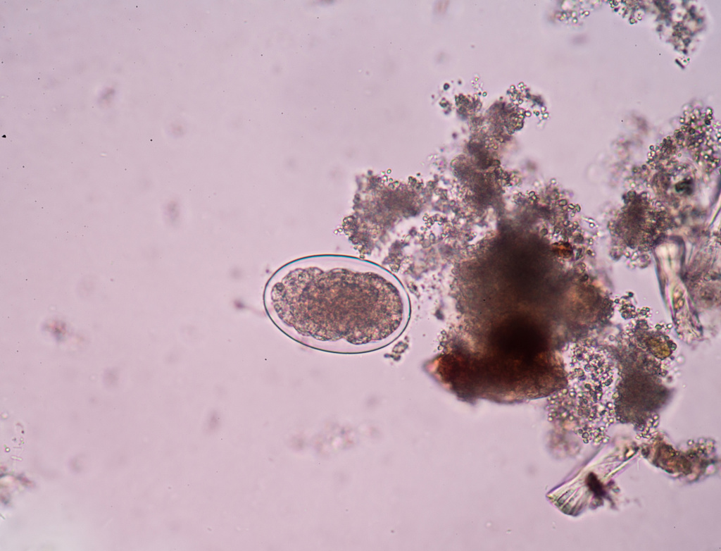 Hookworm Foto: Mostphotos.com