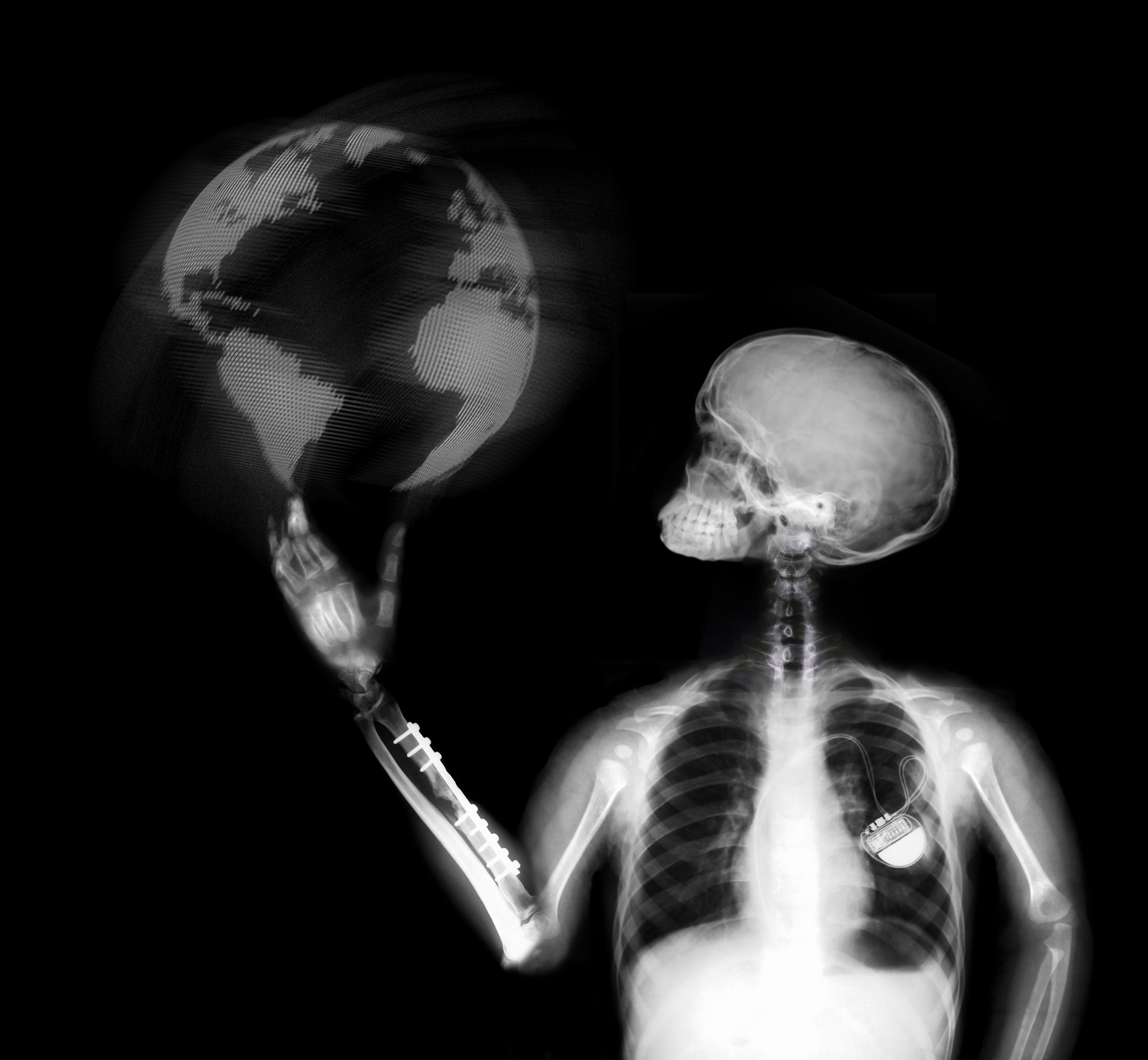 Radiologi illustrasjon